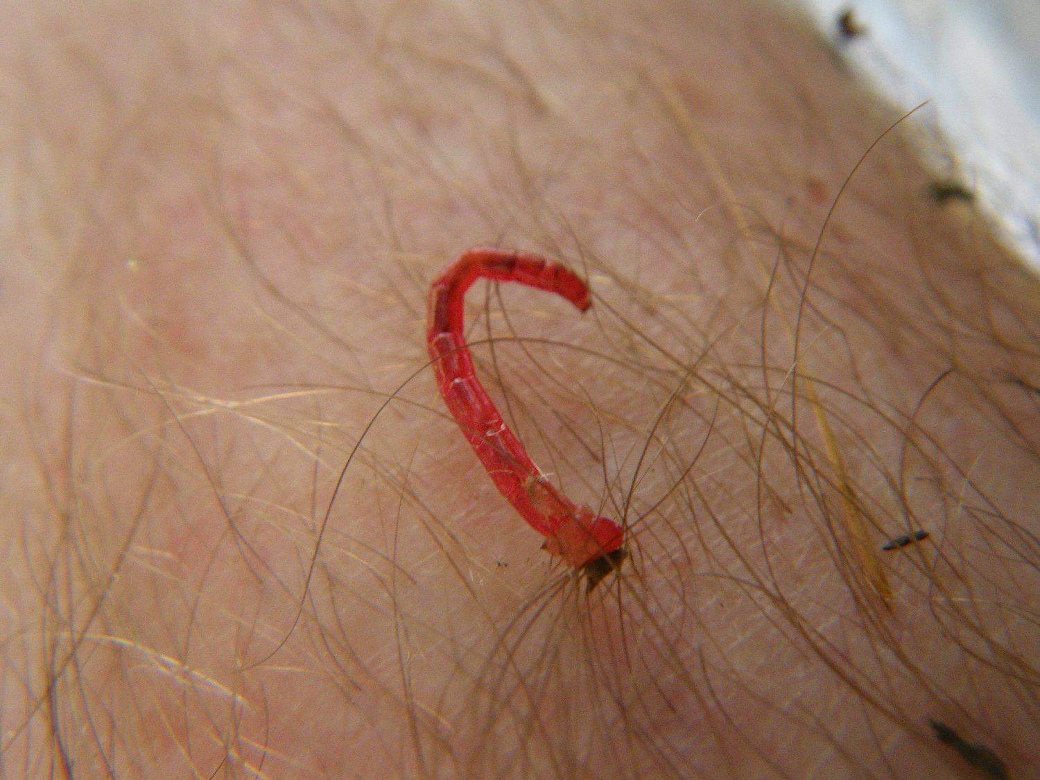 Red Worms Crawling Out Of My Skin After A Session General Discussion 