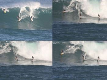 Surfer treats Eye condition by wipeout. - Surfing News